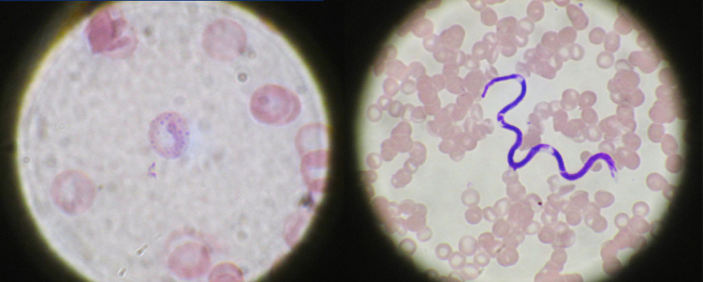 Malaria and microfilaria in human blood smears.