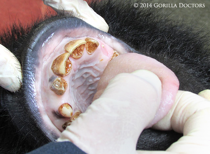 Dr. Jan examines Ndeze's teeth and gums.